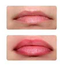 Выраженный контур губ и увеличенье объема губ. 